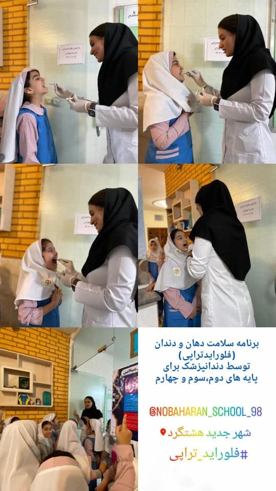 فلورایدتراپی در مدرسه نوبهاران توسط دندانپزشک